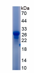 Recombinant Hepatocyte Growth Factor (HGF)