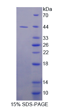 Recombinant Insulin Like Growth Factor 1 (IGF1)