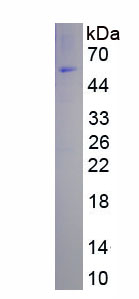 Recombinant Insulin Like Growth Factor Binding Protein 1 (IGFBP1)