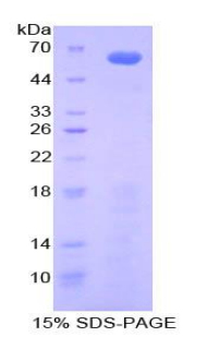 Recombinant Insulin Like Growth Factor Binding Protein 2 (IGFBP2)