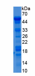 Recombinant Insulin Like Growth Factor Binding Protein 2 (IGFBP2)