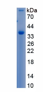 Recombinant Insulin Like Growth Factor Binding Protein 3 (IGFBP3)