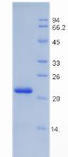 Recombinant Insulin Like Growth Factor Binding Protein 3 (IGFBP3)