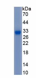 Recombinant Insulin Like Growth Factor Binding Protein 4 (IGFBP4)