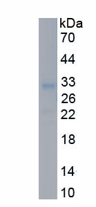 Recombinant Insulin Like Growth Factor Binding Protein 4 (IGFBP4)