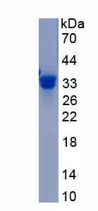 Recombinant Insulin Like Growth Factor Binding Protein 4 (IGFBP4)