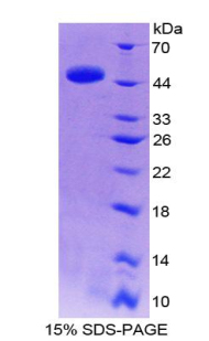 Recombinant Interleukin 10 (IL10)