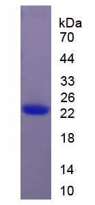 Recombinant Interleukin 11 (IL11)