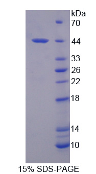 Recombinant Interleukin 12B (IL12B)