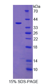 Recombinant Interleukin 12B (IL12B)