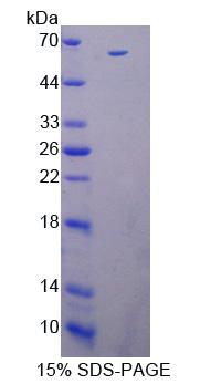 Recombinant Interleukin 12B (IL12B)