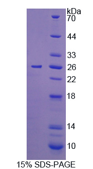 Recombinant Interleukin 12A (IL12A)