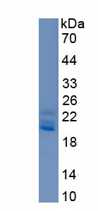 RPA062Hu01.jpg