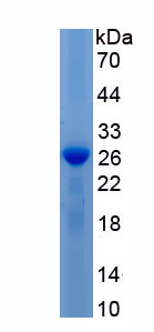 Recombinant Interleukin 17 (IL17)