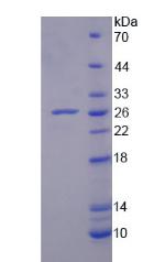 Recombinant Interleukin 18 (IL18)