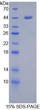 Recombinant Glial Fibrillary Acidic Protein (GFAP)