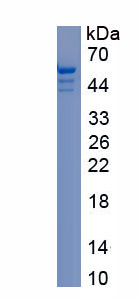 Recombinant Glial Fibrillary Acidic Protein (GFAP)