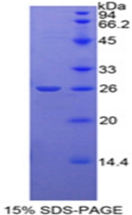 Recombinant Meningioma Expressed Antigen 5 (MGEA5)