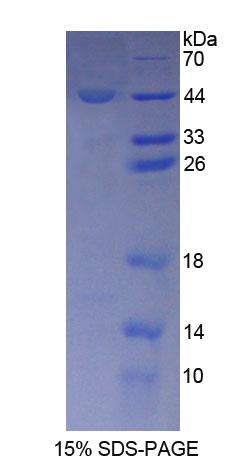 Recombinant Interleukin 2 (IL2)