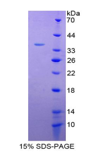 Recombinant Interleukin 4 (IL4)