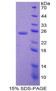 Recombinant Interleukin 6 (IL6)