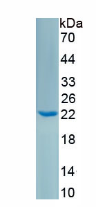 Recombinant Interleukin 6 (IL6)