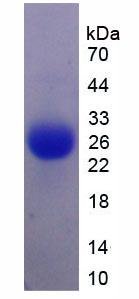 Recombinant Interleukin 6 (IL6)