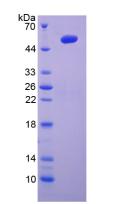 Recombinant Interleukin 6 (IL6)