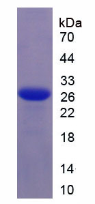 Recombinant Interleukin 6 (IL6)