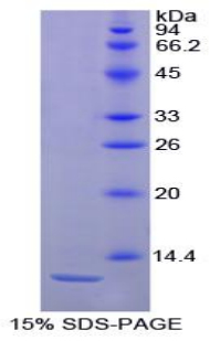 Recombinant Interleukin 8 (IL8)