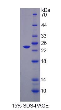 Recombinant Leptin Receptor (LEPR)