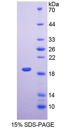 Recombinant Leptin Receptor (LEPR)