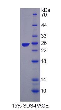 Recombinant Leptin (LEP)