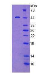 Recombinant Leptin (LEP)