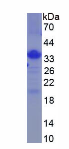 Recombinant Selectin, Leukocyte (SELL)