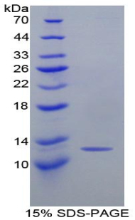 Recombinant Monocyte Chemotactic Protein 1 (MCP1)