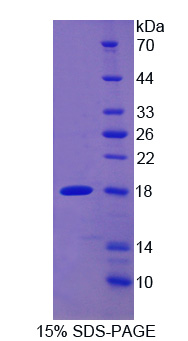 Recombinant Monocyte Chemotactic Protein 1 (MCP1)