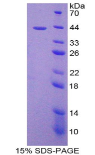 Recombinant Monocyte Chemotactic Protein 2 (MCP2)