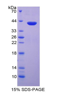 Recombinant Macrophage Inflammatory Protein 1 Alpha (MIP1a)