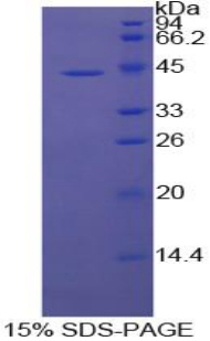 Recombinant Macrophage Inflammatory Protein 1 Beta (MIP1b)