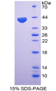 Recombinant Macrophage Inflammatory Protein 1 Beta (MIP1b)