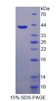 Recombinant Macrophage Inflammatory Protein 1 Beta (MIP1b)