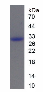 Recombinant Protein SCAF11 (SCAF11)