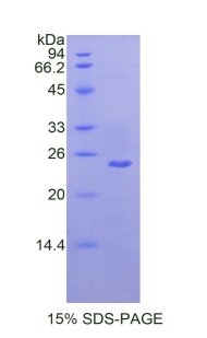 Recombinant Matrix Metalloproteinase 13 (MMP13)