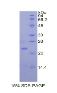 Recombinant Matrix Metalloproteinase 13 (MMP13)