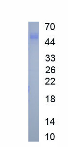 Recombinant Matrix Metalloproteinase 3 (MMP3)