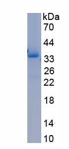 Recombinant Matrix Metalloproteinase 7 (MMP7)