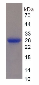 RPA108Hu01.jpg