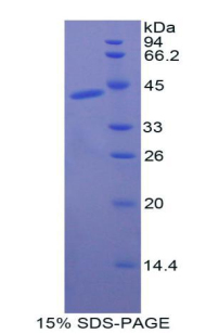 Recombinant Creatine Kinase, Muscle (CKM)