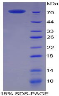 Recombinant Creatine Kinase, Muscle (CKM)